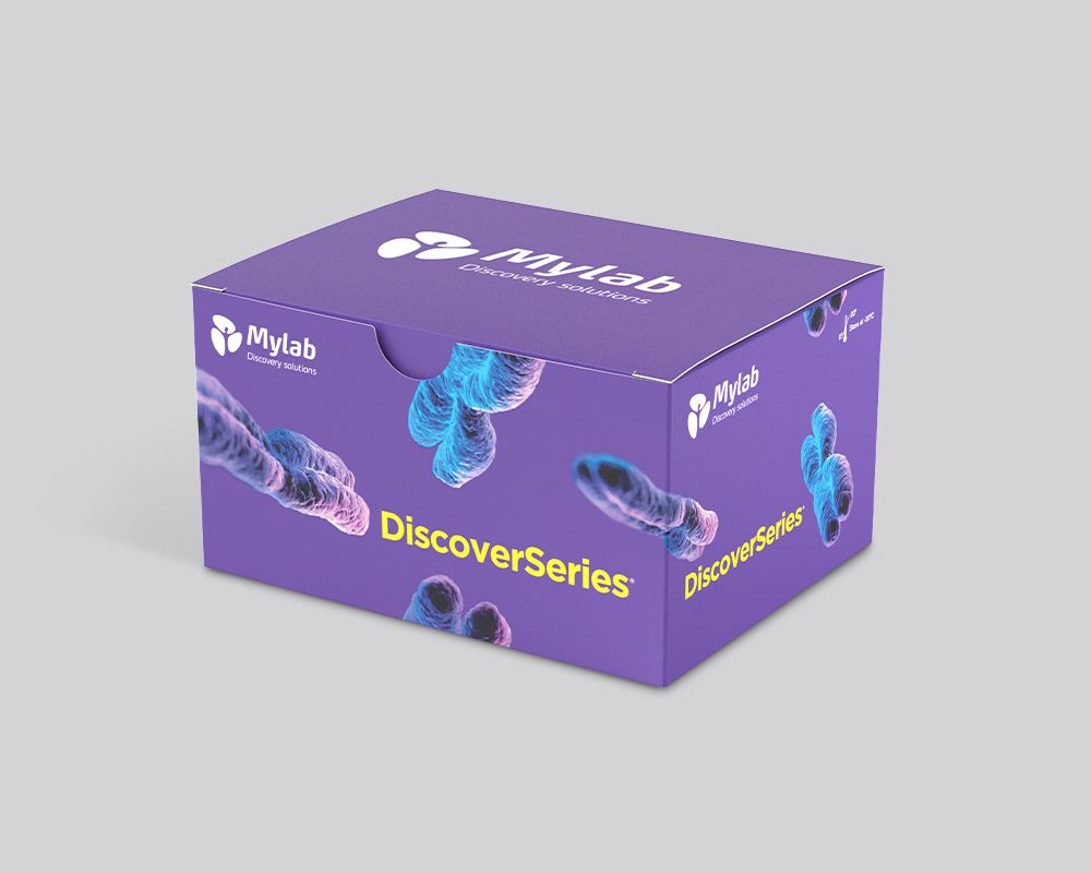DiscoverSeries